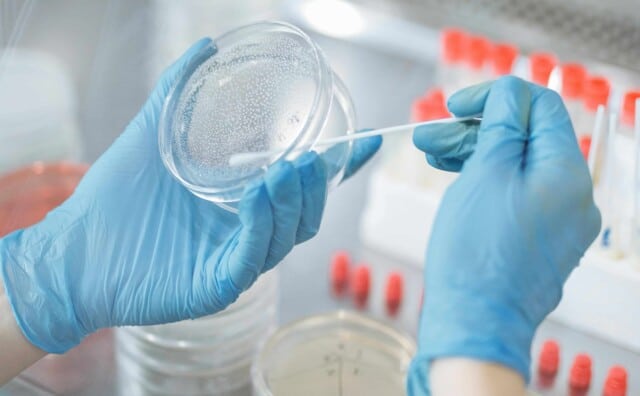 Legionella Water Treatment Systems & Prevention Guide